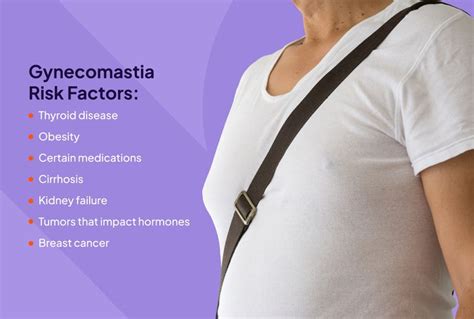 gynecomastia merritt island|Gynecomastia: What It Is, Causes, Diagnosis & Treatment .